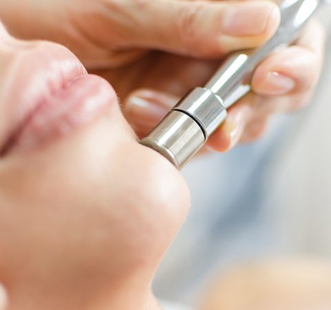 microdermabrasion.jpeg microdermabrasion.jpeg